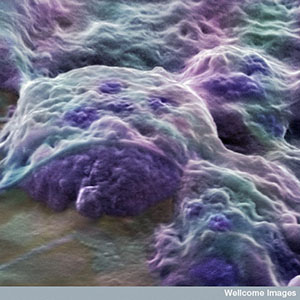 这些来自人类胚胎的胚胎干细胞可以转化为任何类型的细胞。但它们很难获得,而且不能直接用于治疗亨廷顿病。