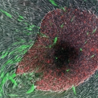 诱导多功能干细胞’被标记成红色和绿色，这些细胞由周围的皮肤细胞逆转化的来（图片来源：美国国家科学院院刊）  