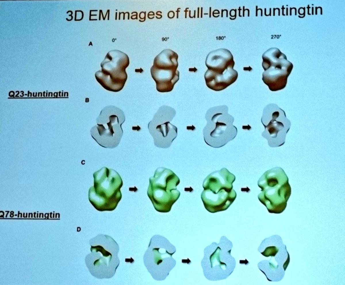 Ihn Sik Seong 展示正常和变异的HD蛋白形状的精彩图片  