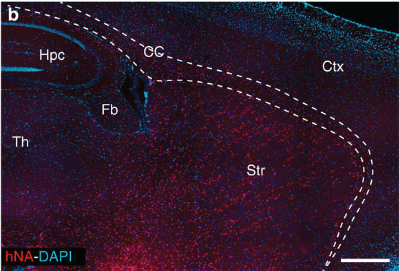 这幅图来自此研究，红点都是成年小鼠大脑的人类胶质细胞-线条表示不同的大脑区域  